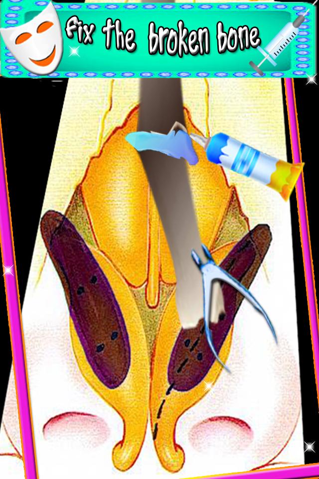 Face Plastic Surgery Simulator