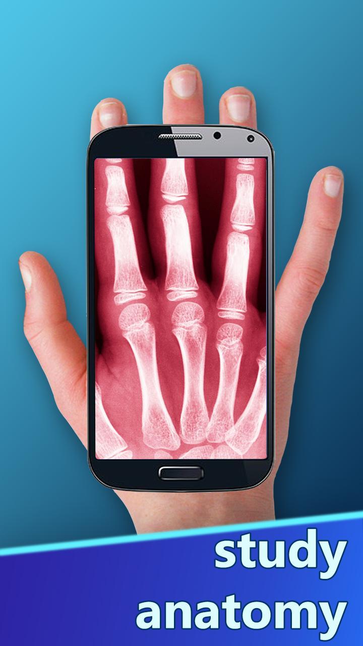 The X-Ray Scanner