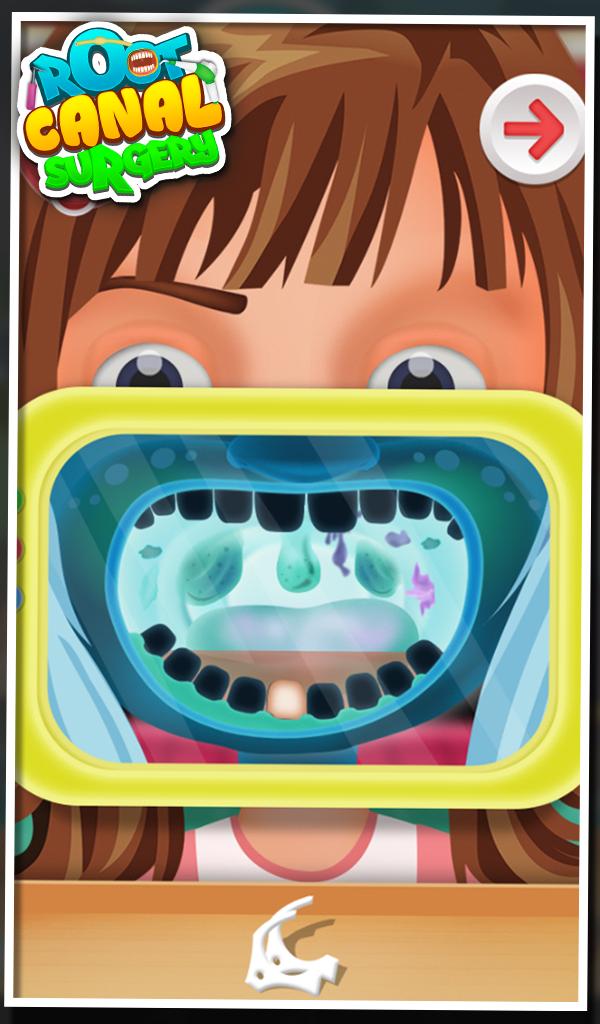 Root Canal Surgery